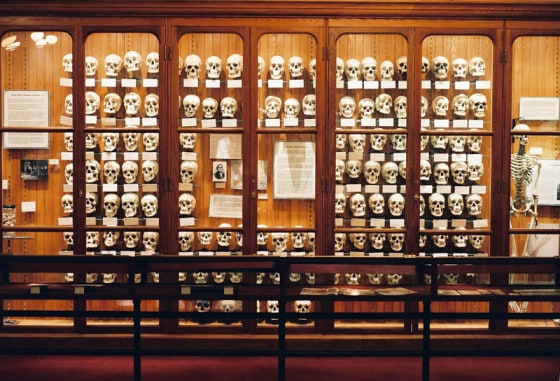 The Mutter Museum, part of the College of Physicians of Philadelphia, was founded in the 1850s to teach doctors about anatomy and medical anomalies. There are abnormal skeletons, photographs of malformed people, and several dozen brains from several dozen species, even the "Secret Tumor of Grover Cleveland."